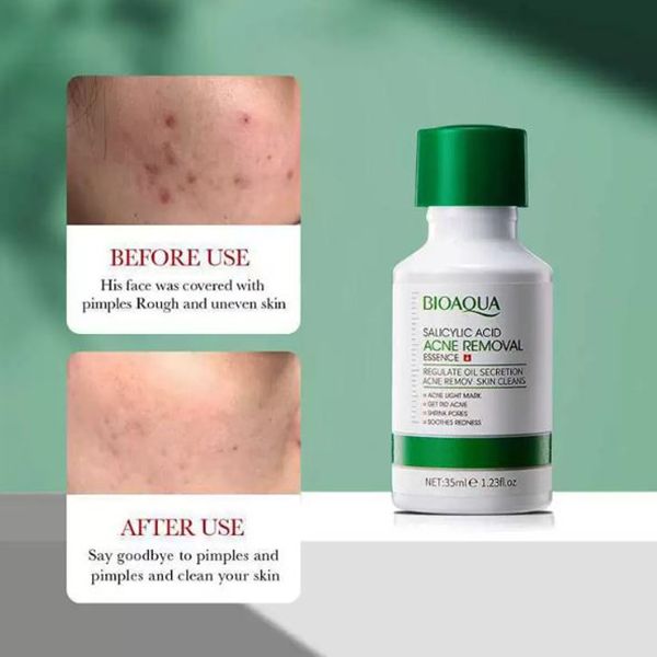 قطره ضدجوش سالیسلیک