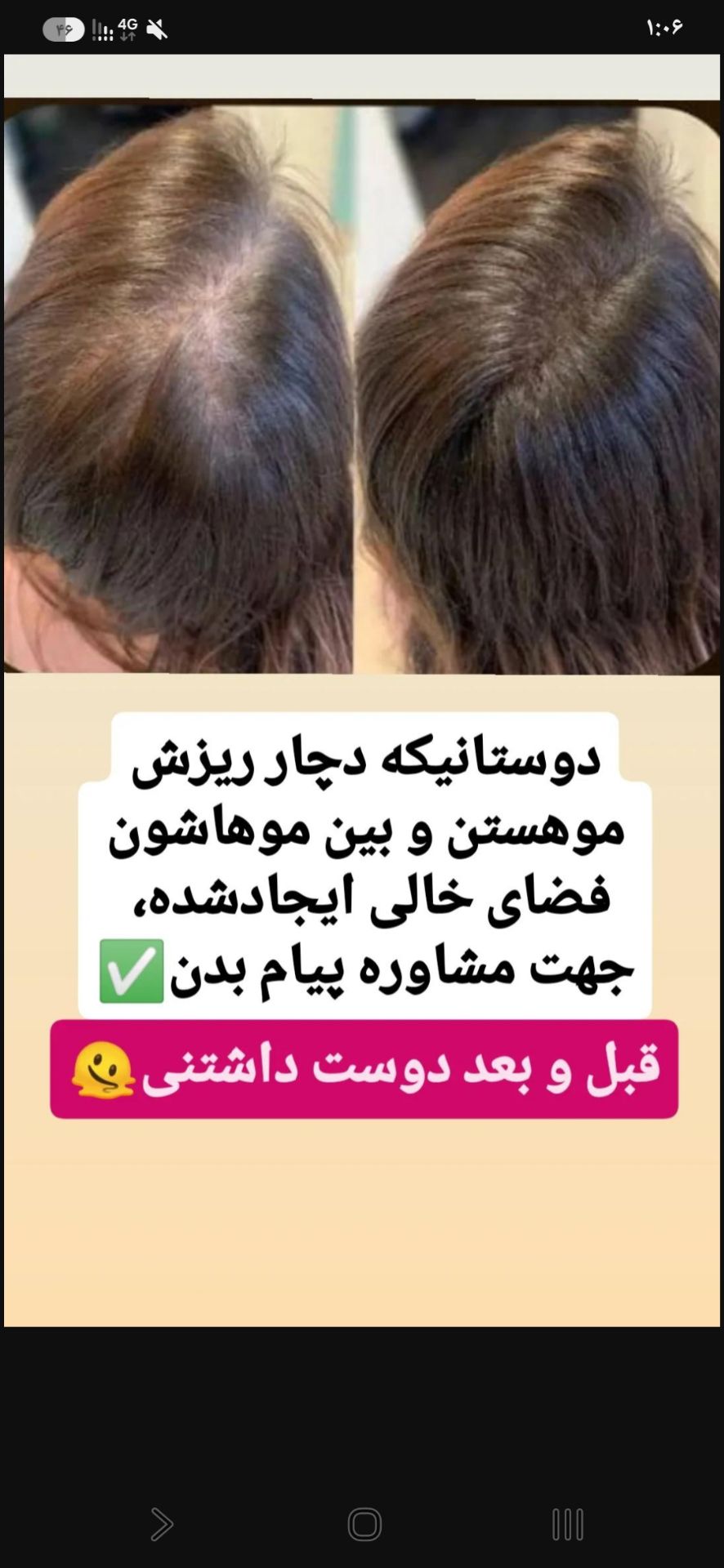 پک تونیک مو کاملا تضمینی