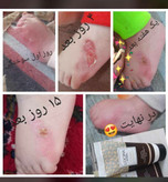 کرم مرطوب کننده دست و صورت