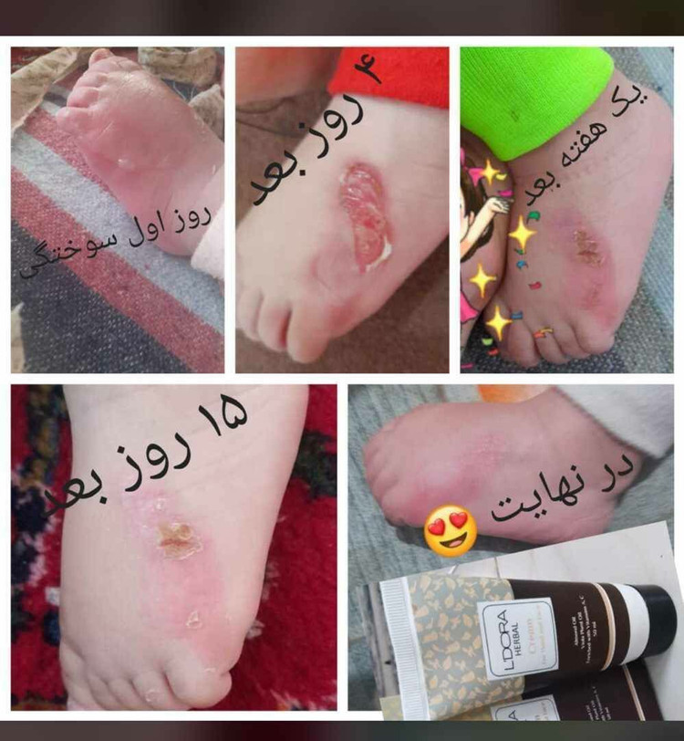 کرم مرطوب کننده دست و صورت